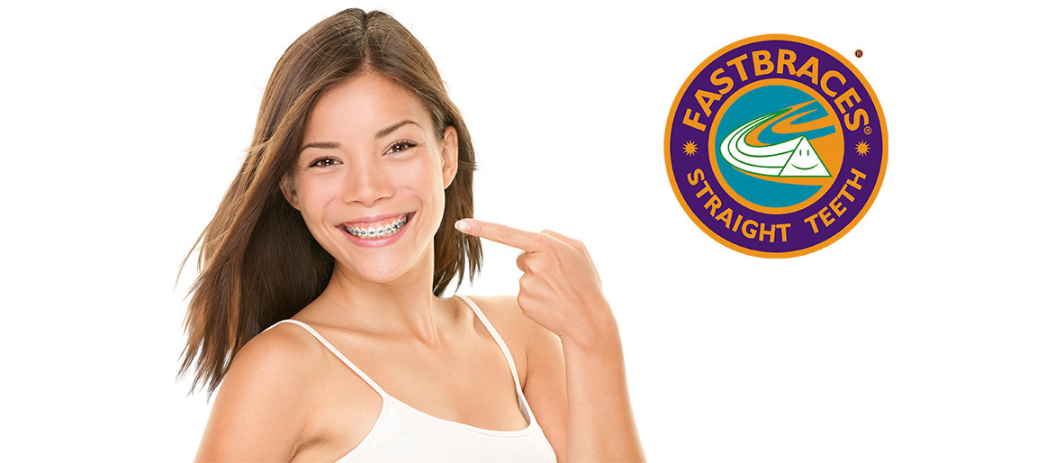 FASTBRACES